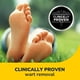thumbnail image 3 of Líquido eliminador de verrugas Dr. Scholl's Clear Away de 10 ml con 20 discos, 3 of 9