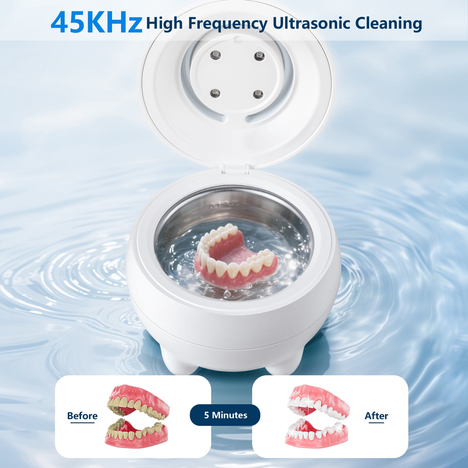 Ultrasonic Retainer Cleaner, 45kHz Ultrasonic Retainer Cleaner Machine Dental Pod, Denture Cleaner for Aligners, Dentures, Night Guards, Jewelry & Rings, Low Noise Compact Cleaner, White