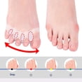 thumbnail image 2 of Gel Toe Separators Bunion Corrector, Silicone Toe Straighteners for Yoga, Toe Spacers Separators for Bent Toes, Hammer Toe, Overlapping Toe, Hallux Valgus, Claw Toes, Gel Toe Protector Stretcher, 4PCS, 2 of 5