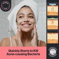 thumbnail image 4 of Limpiador Facial Oxy Máxima Potencia 148 ml con Peróxido de Benzoilo, 4 of 5