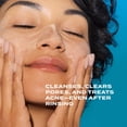 thumbnail image 4 of Murad Acne Control Clarifying Cleanser, Soothes Irritation, 5 fl oz, 4 of 8