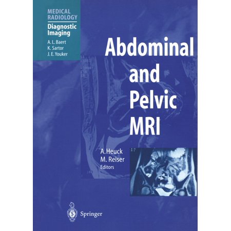 Abdominal And Pelvic Mri Ebook Walmart Com