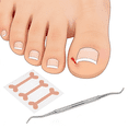 thumbnail image 7 of XIRQI 2026 New 9Pcs Ingrown Toenail Sticker,Embedded Toenail Correction Tool,Practical Light Weight,Non-Woven Fabric,Stainless Steel Ingrown Nail Corrector, 7 of 7