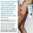 thumbnail image 3 of Exfoliante corporal KP Bump Eraser, queratosis pilaris, tratamiento para mujeres, 3 of 5