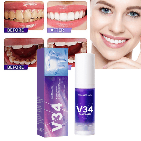 LOYALSE V34 Colour Corrector Teeth Whitening Removal Stain Serum Oral Hygiene