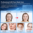 thumbnail image 5 of DGYAO Wireless Silicone LED Face Mask, 8 Colors Rechargeable Light Skincare Facial Mask for Home Beauty Care, Comfortable Fit with Eye Protection, 5 of 7
