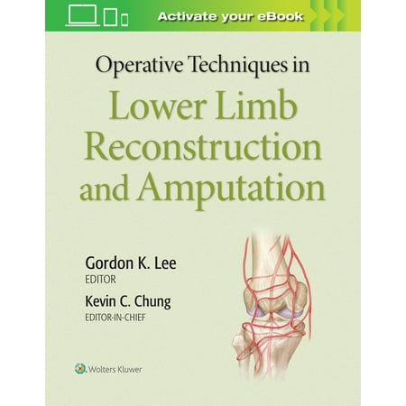 UPC: 9781975127343 | Operative Techniques In Lower Limb Reconstruction And Amputation