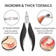 thumbnail image 4 of Thick Nail Tool Kit Pedicure Knife Nail Cutter Cuticle Manicure Kit Foot Care Tools Toe Nail File, 4 of 4