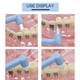 thumbnail image 2 of Soidarity 8 pack/lote de cepillos de dientes de ortodoncia, herramientas fáciles de usar para el mantenimiento de aparatos dentales, cepillo de cuidado de los oídos, 2 of 6