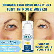 EYE BAG REMOVER, PUFFINESS, Wrinkles, Fine Lines, Dark Circles, 100% ORGANIC Ingredients, With Matrixyl 3000, Hyaluronic Acid, Jojoba Oil, Plant Stem cells and More, Firming Eye Gel - 1 FL OZ.