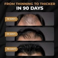 thumbnail image 2 of Champú activador de raíces SPARTAN para hombres (3 unidades) - Champú para el crecimiento del cabello, para la caída y el debilitamiento del cabello, 2 of 5