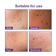 thumbnail image 5 of Promotional activities!Beautiful Night Sky Acne Patches With Tea Oil, Hyaluronic Sour,Calendula Flower Extract, Reduce Acne,Close Acne Marks And Remove Blackheads For Face(180 Count), 5 of 9
