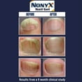 thumbnail image 3 of NonyX Nail Gel 4 Oz (Pack of 7), 3 of 6
