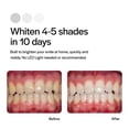 thumbnail image 4 of Bandejas blanqueadoras de dientes Opalescence Go 15% PF (10 tratamientos), 4 of 9