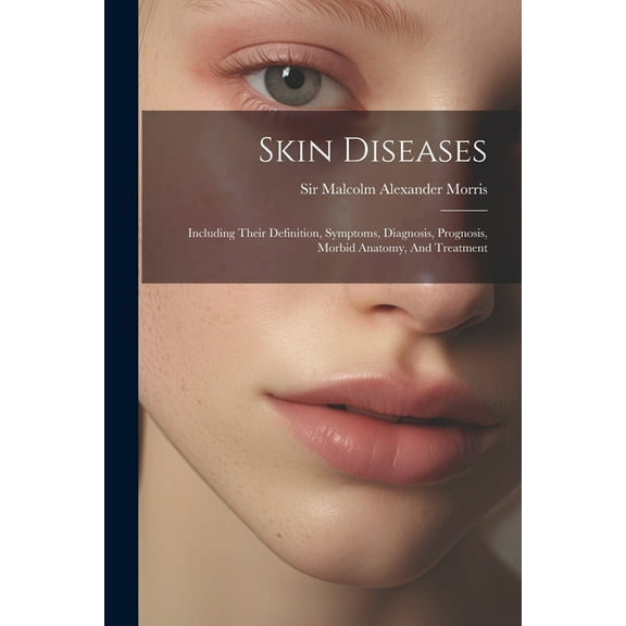 Skin Diseases: Including Their Definition, Symptoms, Diagnosis, Prognosis, Morbid Anatomy, And Treatment (Paperback)