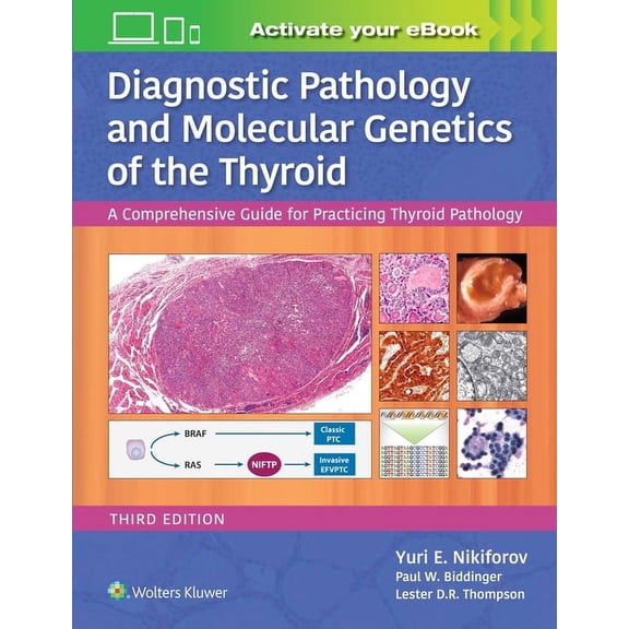 Diagnostic Pathology and Molecular Genetics of the Thyroid: A Comprehensive Guide for Practicing Thyroid Pathology (Hardcover)