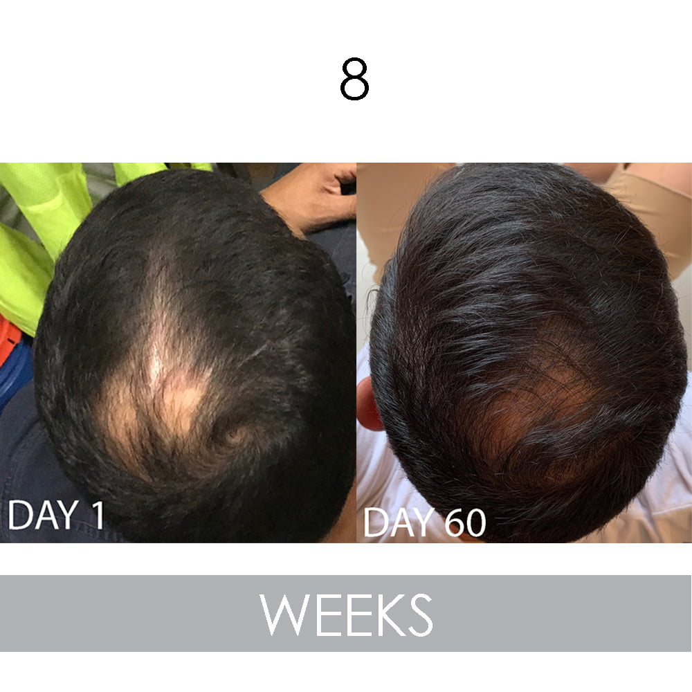 30ml Biotin Hair Growth Essential Oil Thicker Fast Grow Anti Hair Loss  Scalp Nourishing Strengthen Frizz Control Follicle Repair - Walmart.com