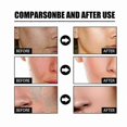 thumbnail image 3 of Facial Brightening Essence with Nicotinic Acid for Hydration and Keratin Removal, 50ml, 3 of 5