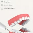 thumbnail image 2 of kurtrusly Ultrasonic Tooth Cleaner Waterproof Teeth Tartaro Remover White Convenient 3, 2 of 6
