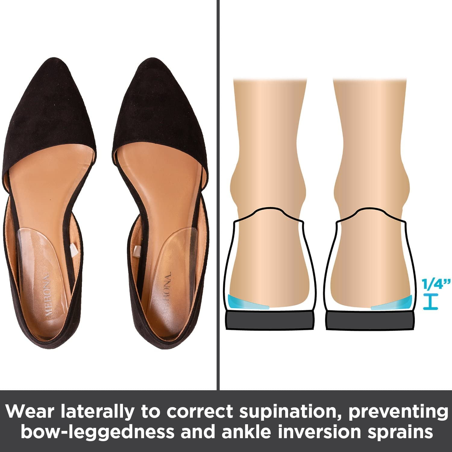 1 Pair Supination & Pronation Corrective Heel Insoles for Adult O