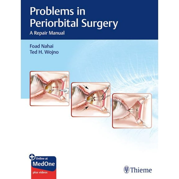 Problems in Periorbital Surgery: A Repair Manual (Hardcover)
