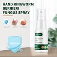 thumbnail image 3 of Spray Caizilan para manos y pies, 20 ml, 3 of 5