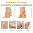 thumbnail image 2 of Râpe à Pieds Electrique recargable, Pédicure Electrique Ponceuse Pied IPX6 Etanche, 3 Vitesses pour Eliminer Les Pieds Peaux Mortes et Callosités Soins des pieds professionnels, 2 of 5