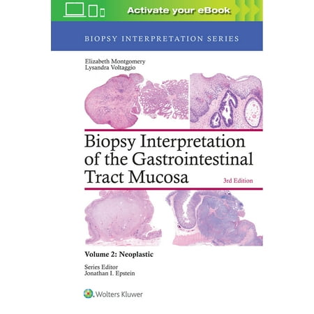 UPC: 9781496337313 | Biopsy Interpretation: Biopsy Interpretation of the Gastrointestinal Tract Mucosa: Volume 2: Neoplastic (Hardcover)