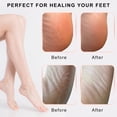 thumbnail image 4 of Fankiway Charging Foot File with Multiple Speeds - Portable Callus Remover for Home Use, 4 of 5