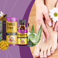 thumbnail image 2 of Foot Care Removal Repair Gel No Irritate Skin Nail Repair Cleansing Liquid for Repairing Onychomycosis, 2 of 5