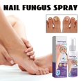 thumbnail image 1 of WIFKLSIIPG Gray Nail Spray Foot & Nail Spray for Toenails & Nails Strengthener 100ml, 1 of 7