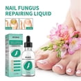 thumbnail image 5 of 3pcs Kerassentials For Toenail Fungus, Kerassentials Toenail Fungus Treatment Oil, 5 of 5
