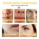 thumbnail image 5 of Esencia para el cuidado de la piel del rostro, Liwei Crema reparadora de oro de 24 quilates 50g para mujeres para reducir las líneas de expresión Liwei Crema reparadora de oro, 5 of 5