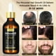 thumbnail image 3 of Kit de aceite para el crecimiento del cabello Sefralls con 5% de minoxidil para hombres y mujeres, 3 of 6