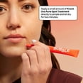 thumbnail image 5 of Bubble Skincare Acne Kit, All Skin Types, 3 Items Included, 5 of 5