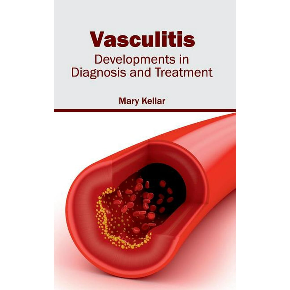 Vasculitis Developments in Diagnosis and Treatment (Hardcover)
