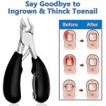 thumbnail image 2 of podiatrist toenail clippers, professional thick ingrown toe nail clippers for men seniors, pedicure clippers toenail cutters, super sharp curved b, 2 of 5