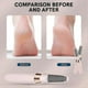 thumbnail image 5 of Portable USB Electric Foot Grinder File Vacuum Hard Remover Callus Skin, 5 of 5