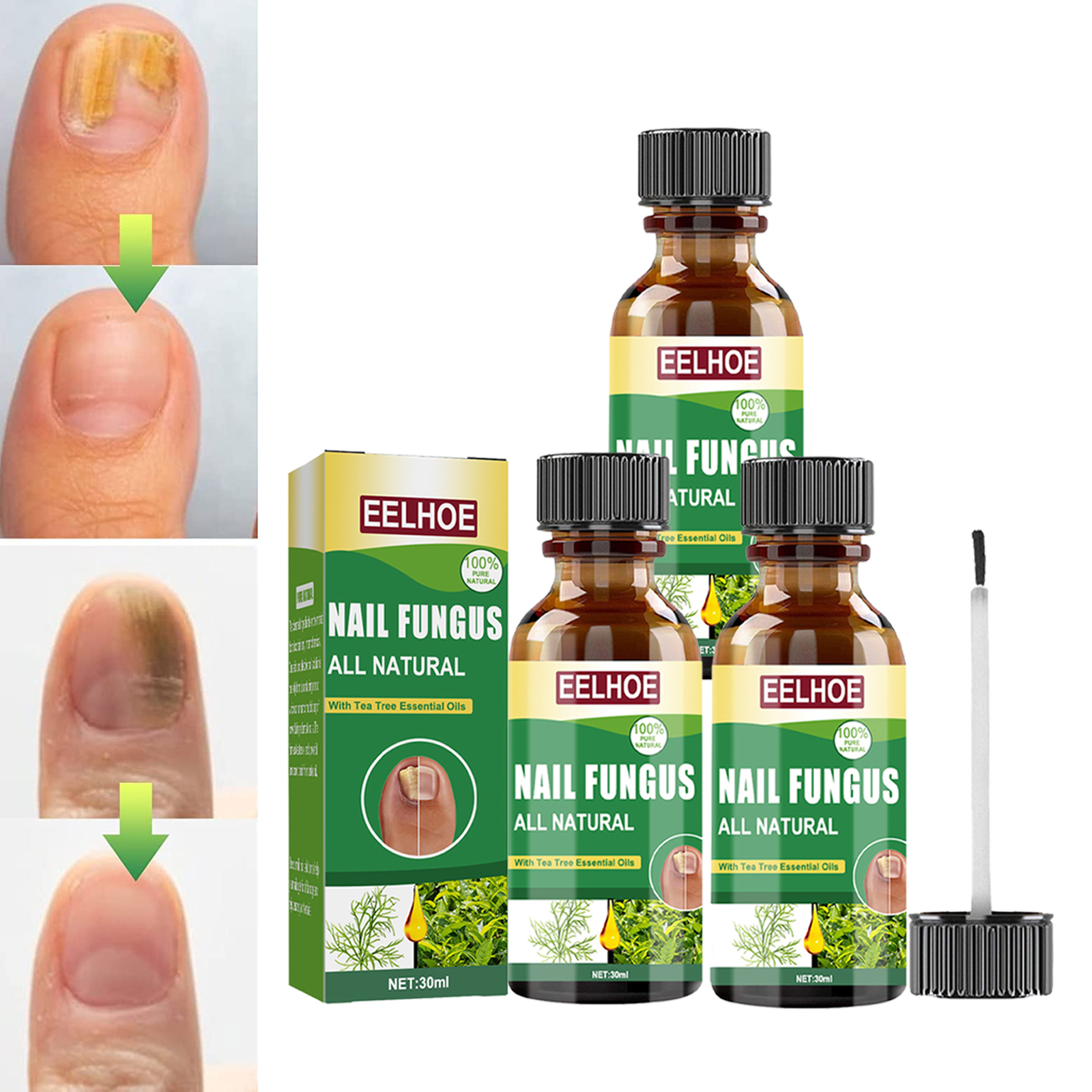 Toenail Fungus Treatment, Effective Nail Fungus Treatment for Toenail