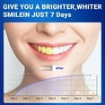 thumbnail image 4 of Teeth Whitening Strip - 56 Strips Professional and Safe Teeth Whitening Kit for Teeth Sensitive, Mint, 4 of 9
