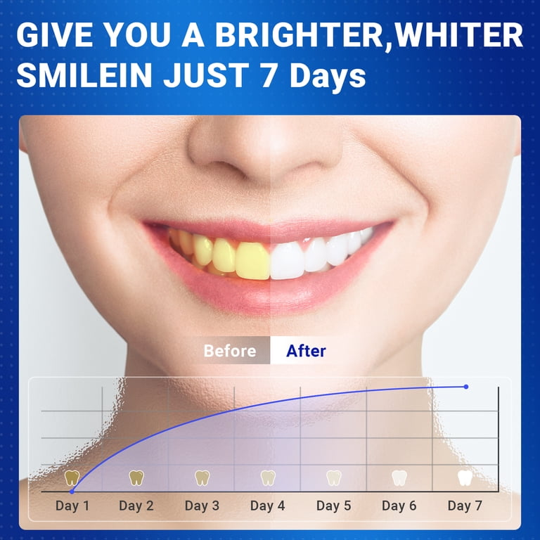 Teeth Whitening Strips, Professional 56-Count Kit, Sensitive photo 3