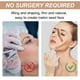 thumbnail image 5 of Fiudx Lifting Facial, Parches Mifasciales Antiarrugas, Bandas Reafirmantes para Cuello, Solución Antiedad, Apta para Pieles Sensibles, Rutina de Uso Nocturno, Atención Al Cliente 24 Horas, 5 of 7