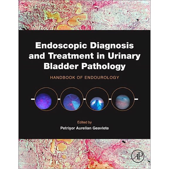 Endoscopic Diagnosis and Treatment in Urinary Bladder Pathology: Handbook of Endourology, (Hardcover)