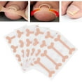 thumbnail image 4 of Wchiuoe Ingrown Nail Correction Bandage Pain Relief Paronychia Treatment Band Sticker 24pcs, 4 of 10