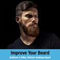 thumbnail image 2 of Tilcare Beard and Hair Derma Roller (1Pack) - 1200 Grade A Titanium Microneedles Titanium Derma Roller 0.25mm, 2 of 6