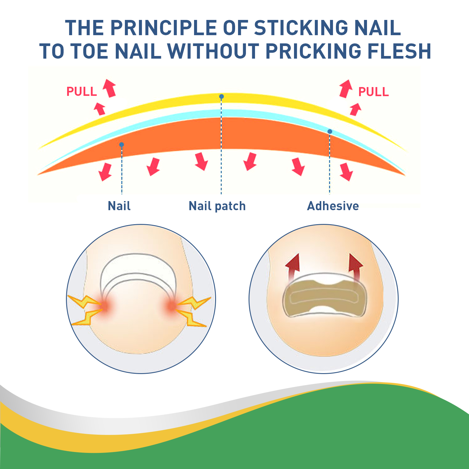 Alvantor Ingrown Toenail Treatment, Breathable Ingrown Toenail Corrector Patches