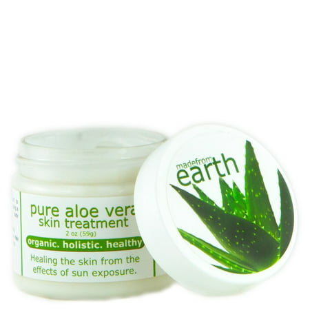 Eczema Treatment | Healing Dermatitis and Inflammation | Organic Aloe Vera & Coconut
