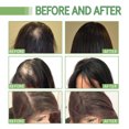 thumbnail image 4 of Juego de rodillos de suero para el cabello ANGGREK orgánico, 4 of 8