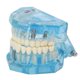 thumbnail image 1 of Modelo de dientes para enfermedades dentales estructura detallada azul transparente desmontable aprendizaje modelo de enseñanza patológica acrílico para hospital dental ANGGREK Otros, 1 of 8