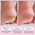 thumbnail image 3 of Mascarilla exfoliante para pies ganadora del premio Grace & Stella con aloe vera, 4 pares, 3 of 8